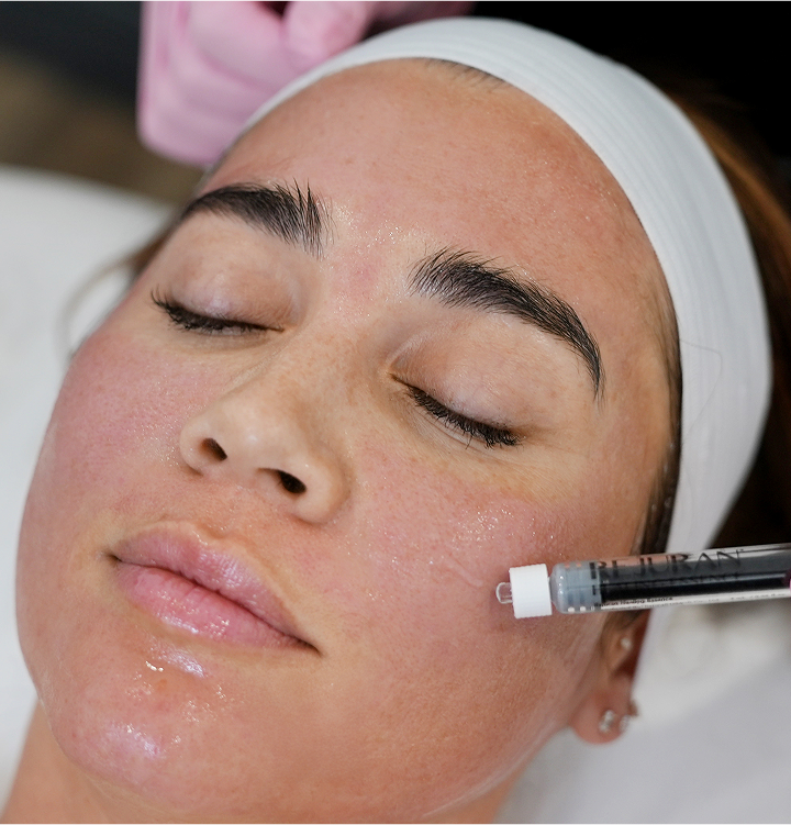 REJURAN® SALMON DNA TREATMENT