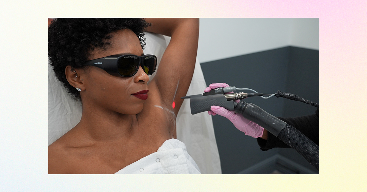 Laser away article image for What Is The Fitzpatrick Scale? Everything You Need To Know About Skin Types
