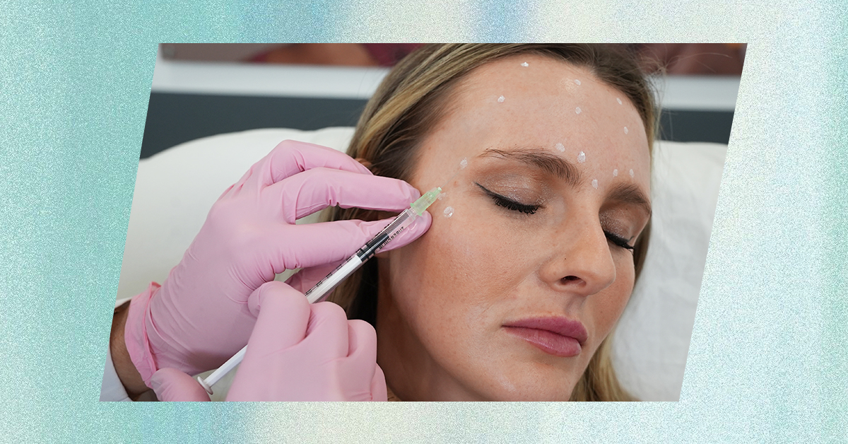 Laser away article image for Is Preventative Botox Worth It?