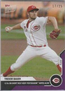 Trevor Bauer