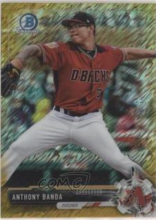 Anthony Banda