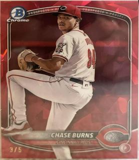 Chase Burns