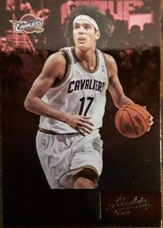 Anderson Varejao
