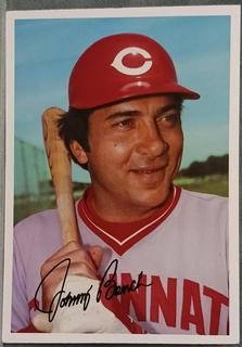Johnny Bench