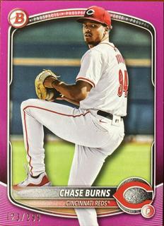 Chase Burns