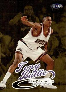 Tony Battie