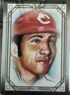 Johnny Bench