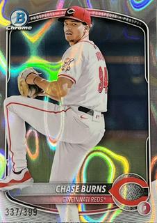 Chase Burns