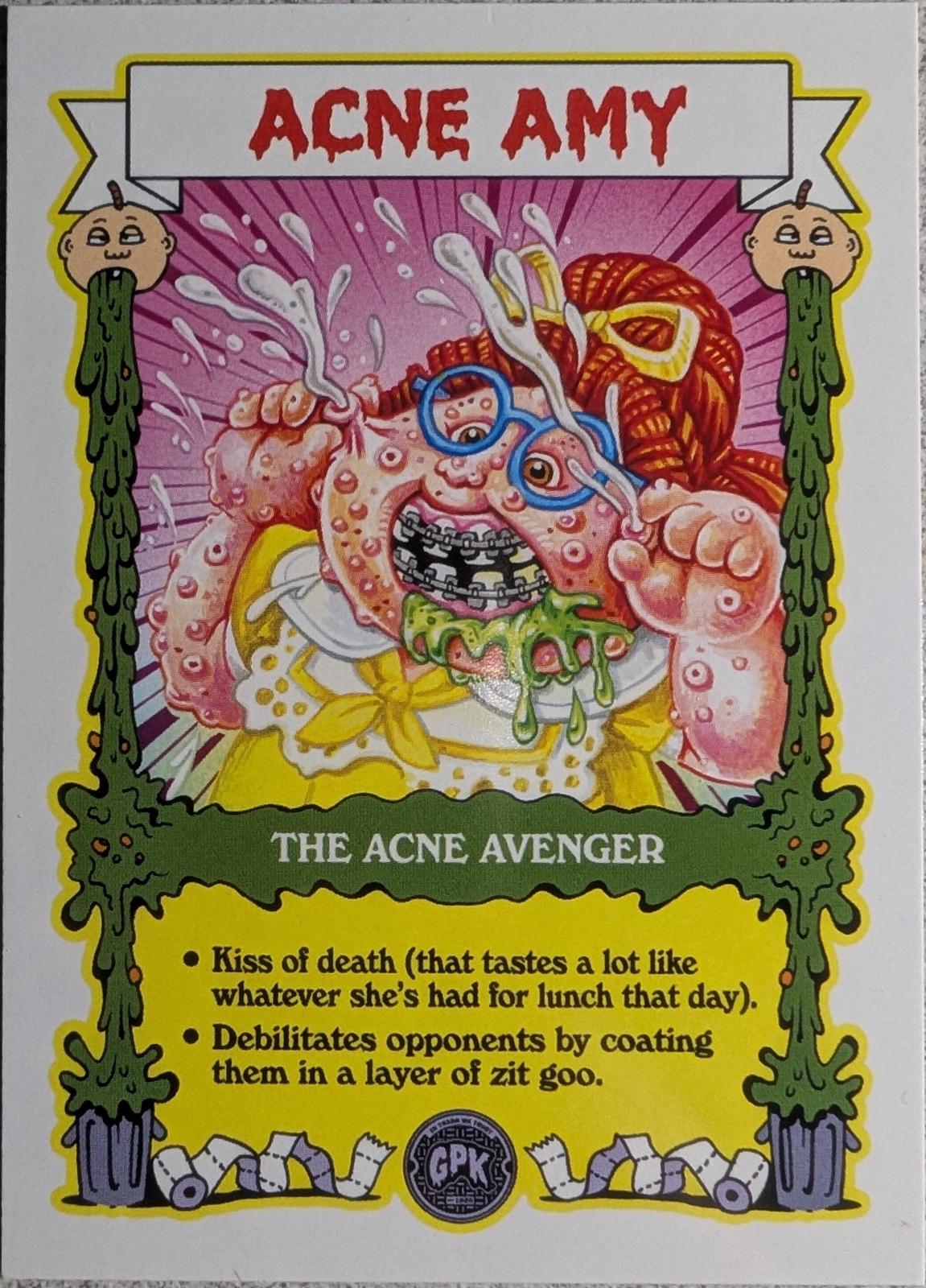 ACNE AMY #TCG-10 Garbage Pail Kids at Play TCG