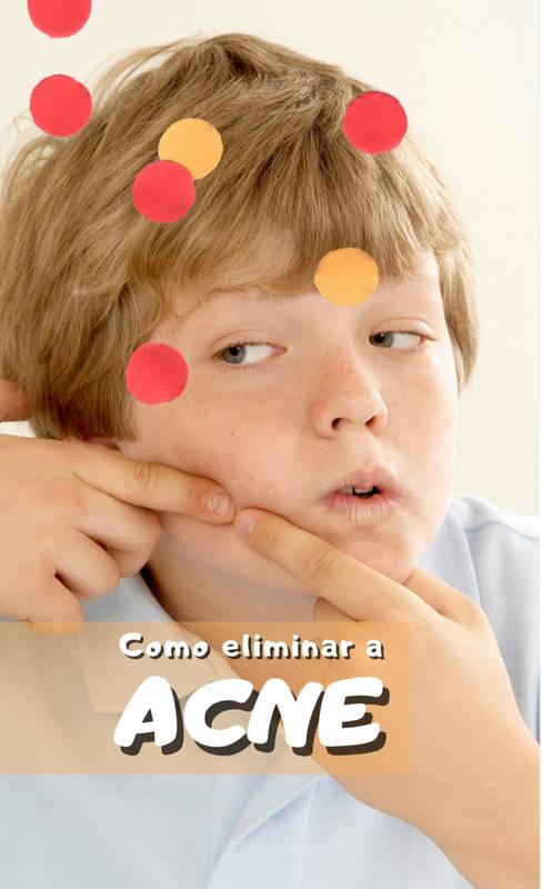 Como eliminar a ACNE