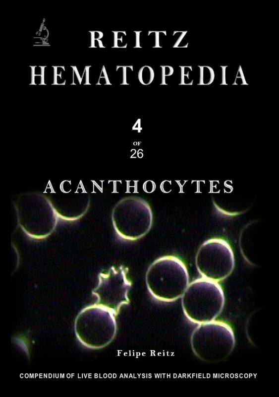 Acanthocytes