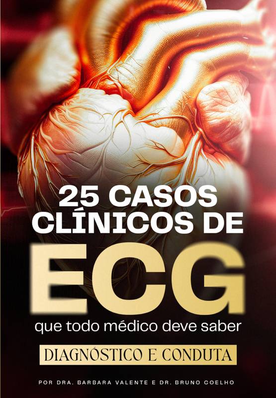 25 Casos Clínicos de ECG que todo médico deve saber