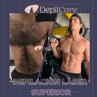 One of the top publications of @depilcare.col which has 64 likes and 2 comments