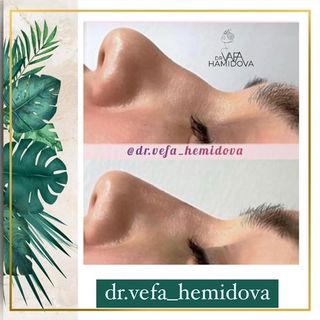 One of the top publications of @dr.vefa_hemidova which has 12 likes and 1 comments
