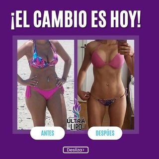 One of the top publications of @lipoblue_supreme_oficial which has 2 likes and 0 comments