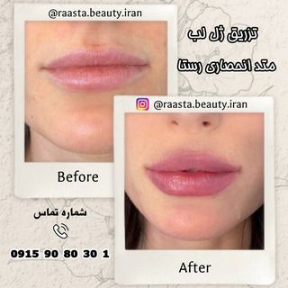 One of the top publications of @raasta.beauty.iran which has 116 likes and 13 comments