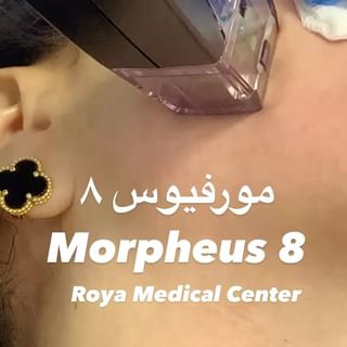 One of the top publications of @royamedicalcenter.ae which has 81 likes and 0 comments