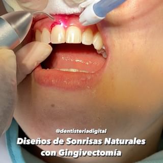 One of the top publications of @dentisteriadigital which has 468 likes and 5 comments