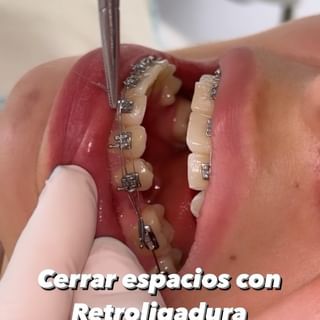 One of the top publications of @dentisteriadigital which has 1.9K likes and 22 comments