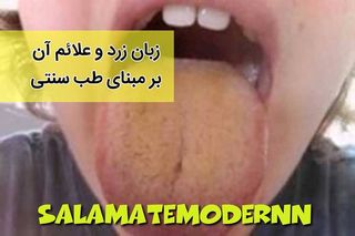 One of the top publications of @salamatemodernn which has 240 likes and 24 comments