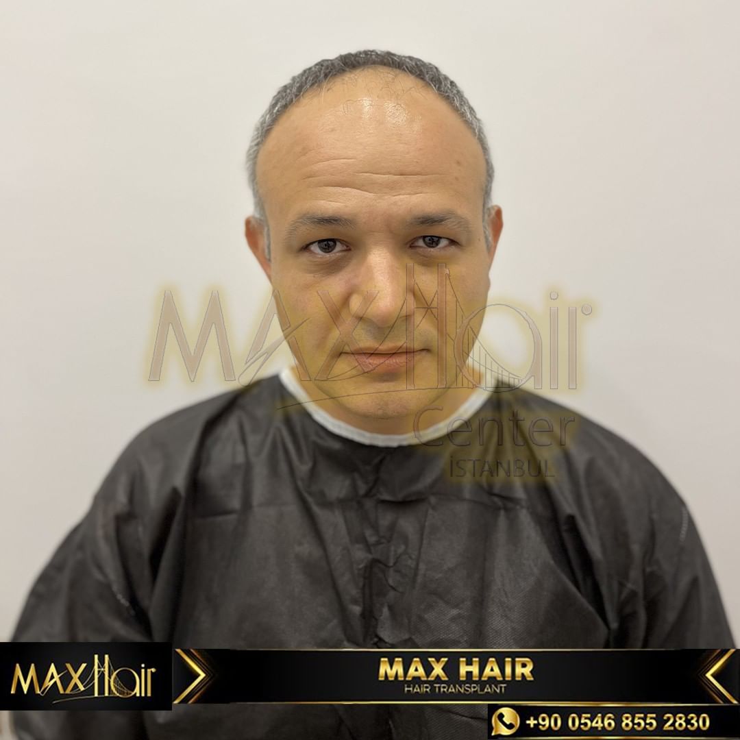 One of the top publications of @maxhairinternational which has 16 likes and 0 comments