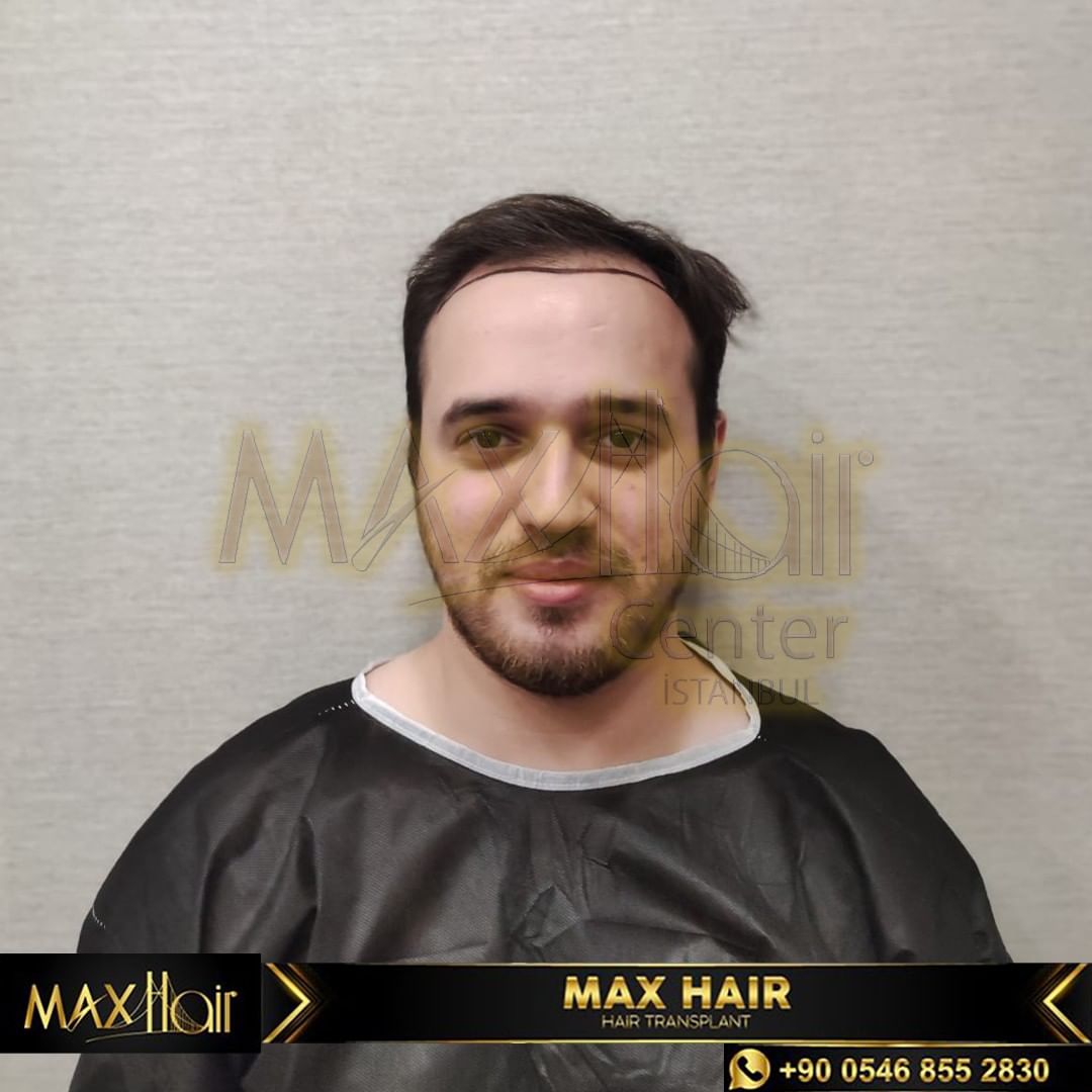 One of the top publications of @maxhairinternational which has 6 likes and 0 comments