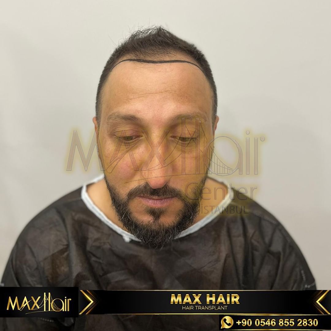One of the top publications of @maxhairinternational which has 8 likes and 0 comments