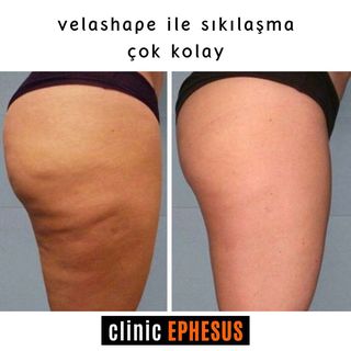 One of the top publications of @clinic_ephesus which has 107 likes and 0 comments