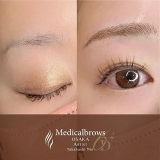 One of the top publications of @medicalbrows which has 16 likes and 0 comments