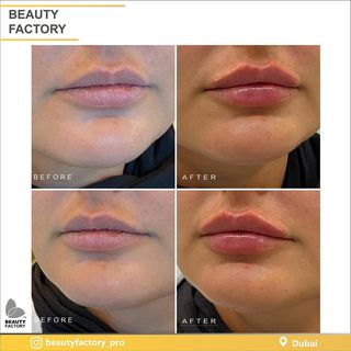 One of the top publications of @beautyfactory_pro which has 3.5K likes and 38 comments