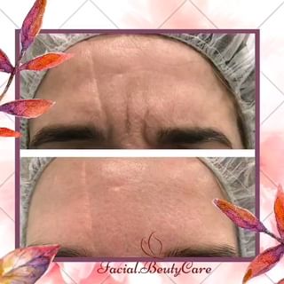 One of the top publications of @facial.beautycare which has 738 likes and 11 comments
