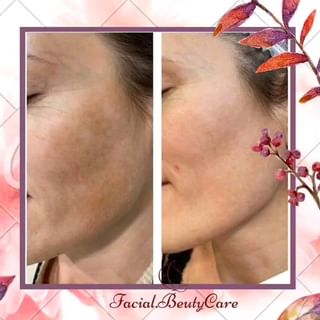 One of the top publications of @facial.beautycare which has 469 likes and 11 comments