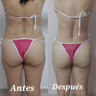 One of the top publications of @esteticavivante which has 15 likes and 1 comments