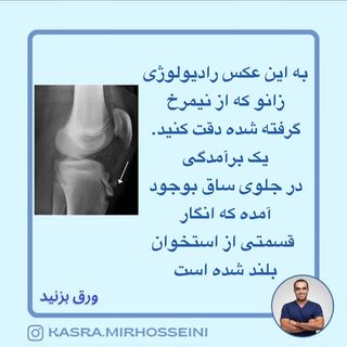 One of the top publications of @kasra.mirhosseini which has 5.2K likes and 154 comments