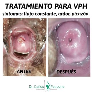 One of the top publications of @drcarlospetroche which has 781 likes and 242 comments