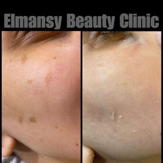 One of the top publications of @elmansy_beauty_clinic which has 28 likes and 4 comments