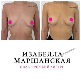 One of the top publications of @izabella_marshanskaya_anatomy which has 340 likes and 16 comments