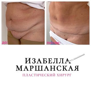 One of the top publications of @izabella_marshanskaya_anatomy which has 294 likes and 2 comments