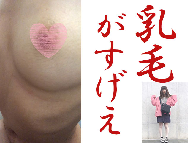 全て未処理の奇跡の剛毛！乳毛をアップで観察！オシャレでかわいいのに… gallery photo 1