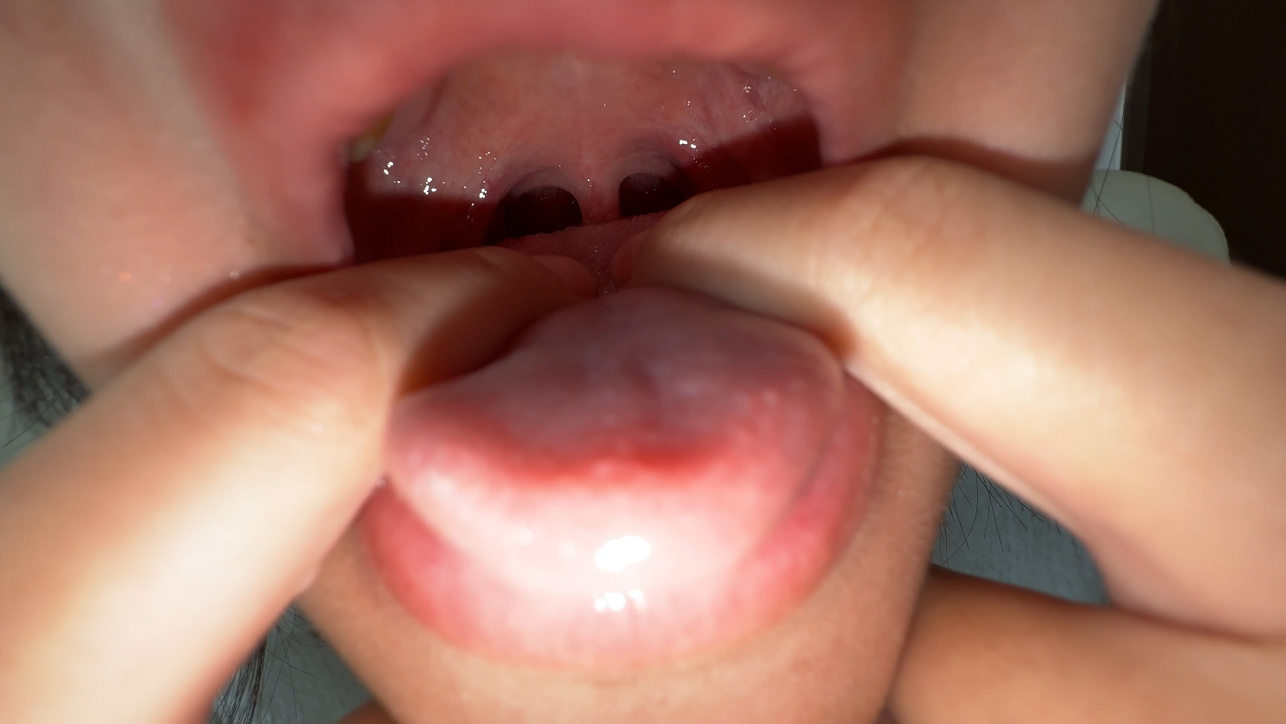 【個人撮影】乙葉らぶの喉チン触り＆開口器アヘ顔Wピース