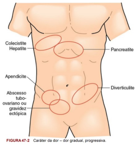 ABDOME AGUDO - Cirurgia Geral I