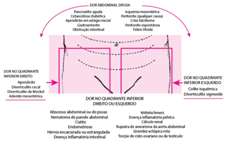 Abdome agudo em ginecologia: tipos, diagnósticos e tratamento - Medway