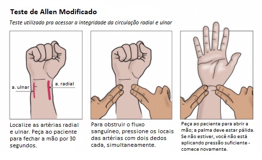 Gravura ilustrando o Teste de Allen modificado