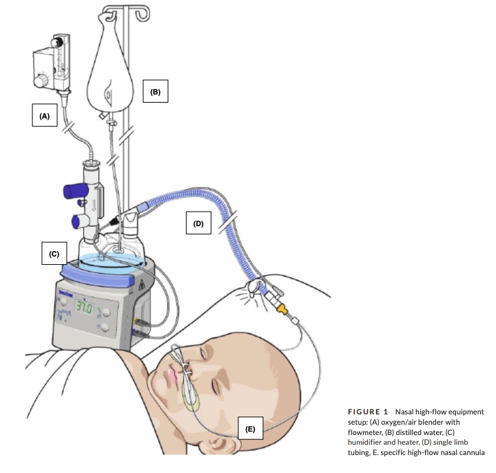 Ilustração da cânula nasal de alto fluxo, dispositivo utilizado no tratamento da bronquiolite viral aguda