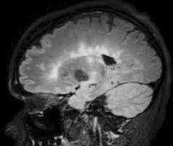 Veja 5 questões de neurologia comentadas e teste seus conhecimentos. O estudo por questões é a melhor forma de reter o aprendizado.