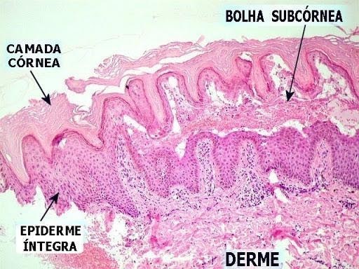 Estude para as provas de residência médica com 5 questões de Dermatologia comentadas