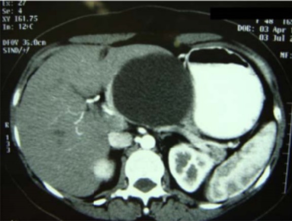 Veja 5 questões de Cirurgia Geral comentadas, que podem te ajudar a aprimorar seus estudos e alcançar melhores resultados.