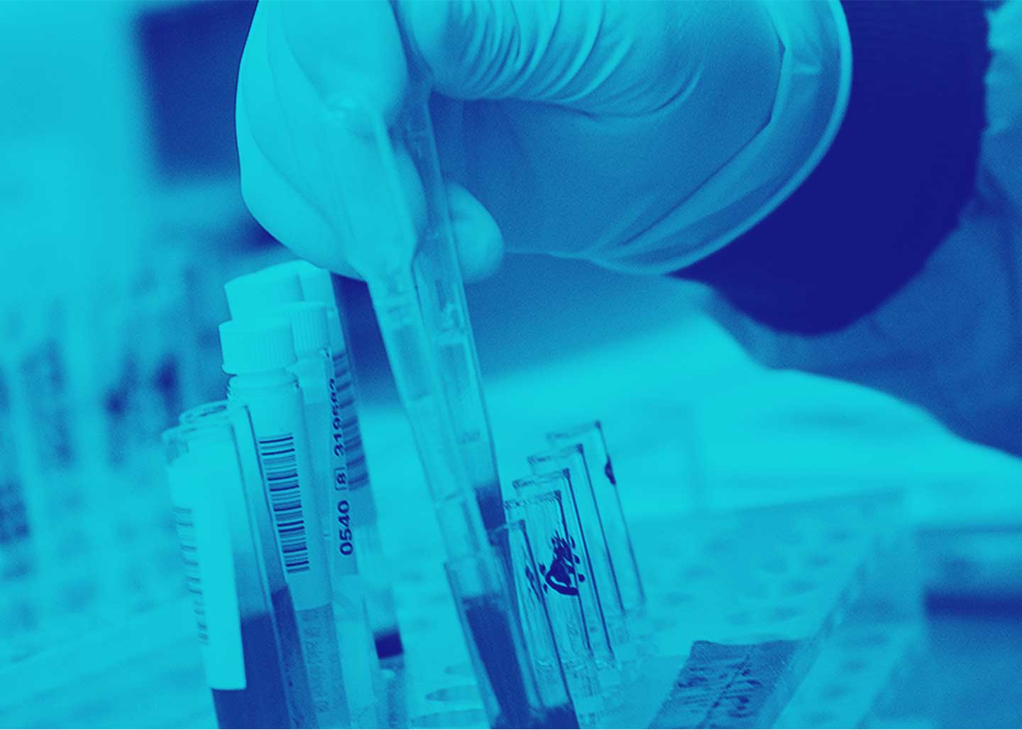 Como Interpretar As Sorologias E Anticorpos Da Hepatite B Medway