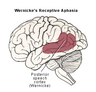 Representação, em vermelho, da área de Wernicke.