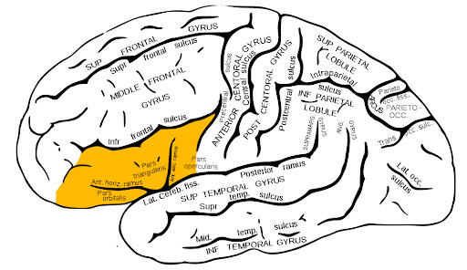Representação do giro frontal inferior esquerdo em amarelo, onde se encontra a área de Broca, que cursa a afasia de broca.